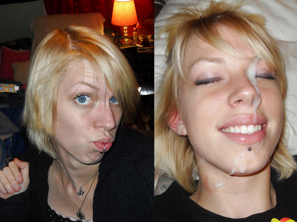 Sex Before-After Facials image