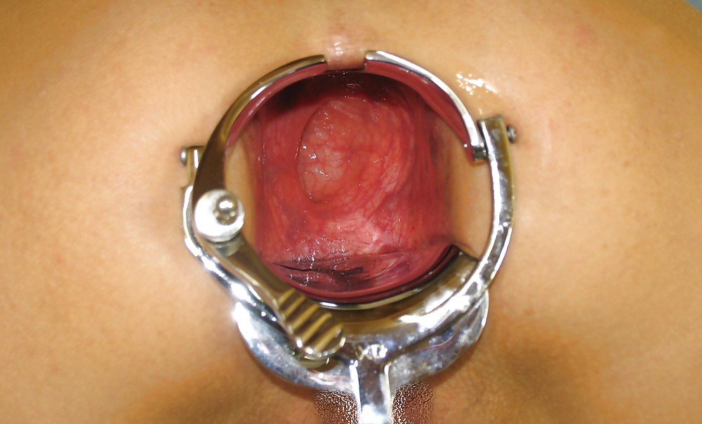 Sex Pictures of incredible anal insertions by M.D.F. image