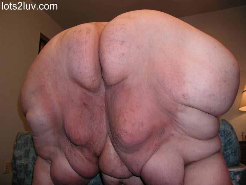 SSBBW REALITY - discolored skin, scars, bedsores, acne - 42 Photos 