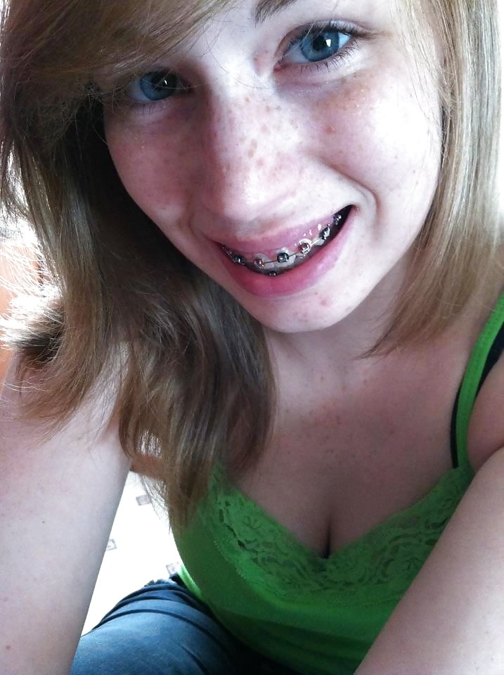 Metal Mouth Cum Facial Targets 10 Pics