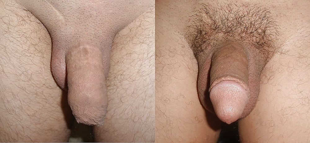 Foreskin Penis Cock Ring Prolong Delay Premature Ejaculation Erection Enhancer