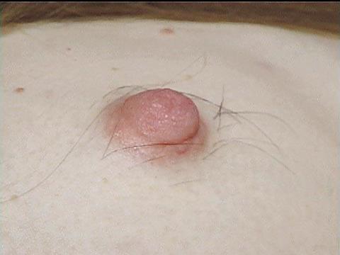 Sex women with hairy breasts image