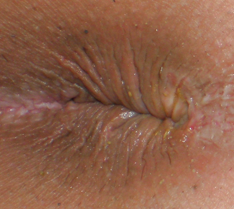 Sex My girlie butthole as 18 y 3 m old image