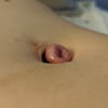 My Outie Belly Button Torture