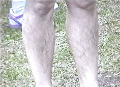 Sex women with hairy legs image