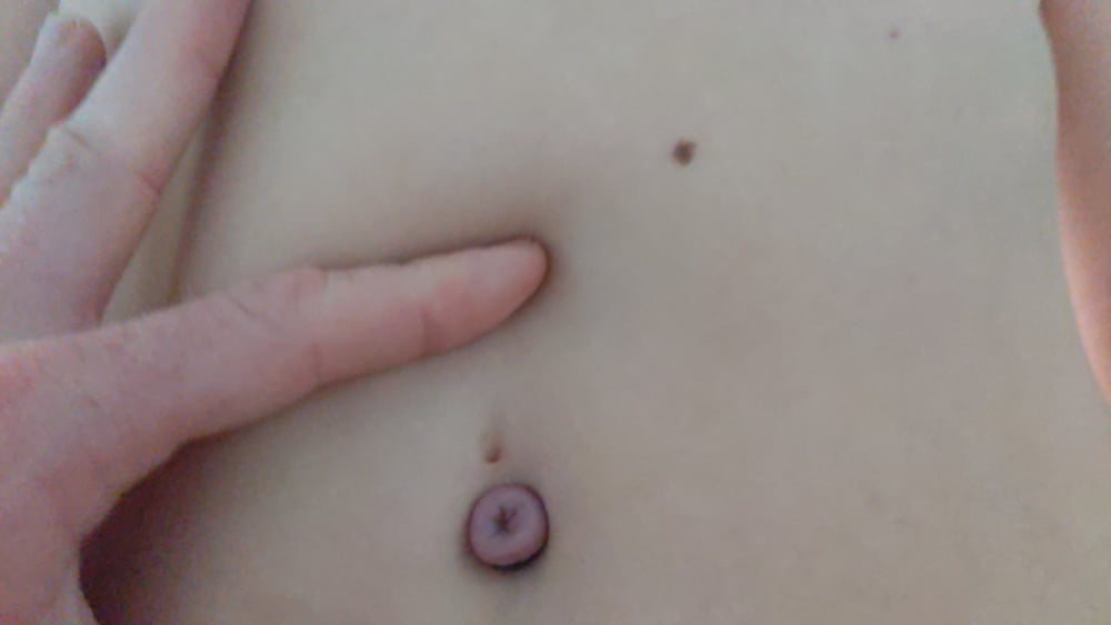 My Outie Belly Button Torture.
