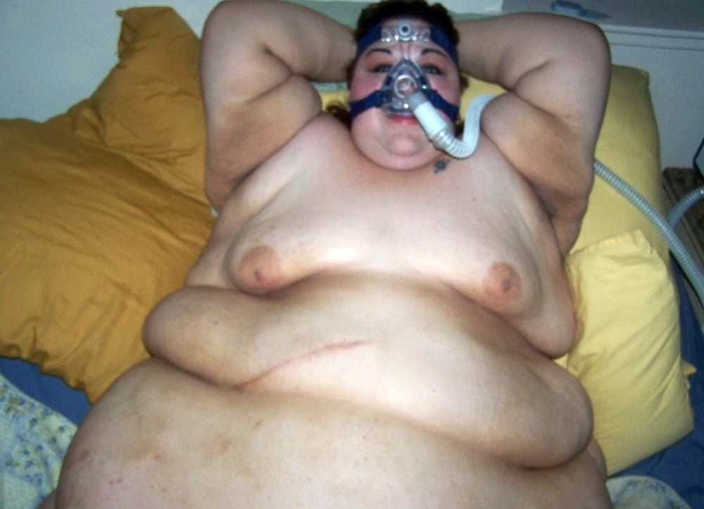 SSBBW With Breathing Or Mobility Apparatus - 15 Photos 