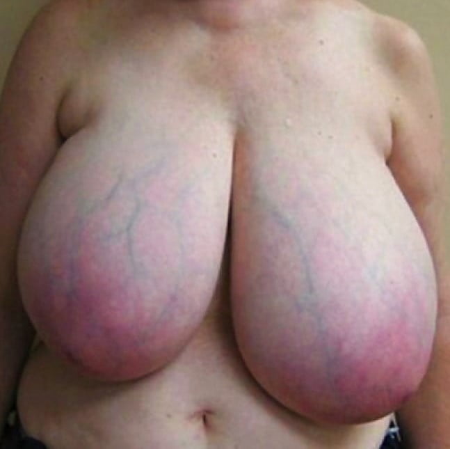 Different Words same thing.Titten Tetas Breasts Boobs. 372 - 100 Photos 