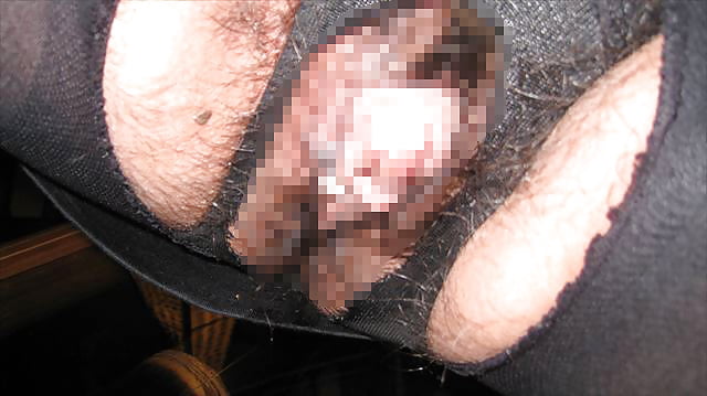 Sex The clitoris is made big by a hormone and suction. image