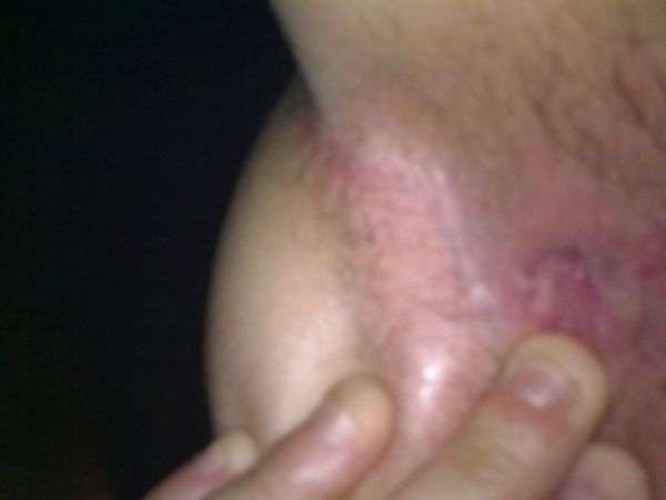 Sex Ex-Girlfriends image