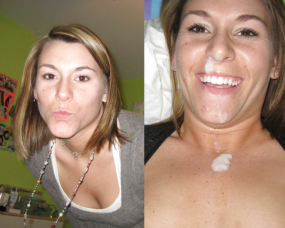 Sex Before-After Facials image