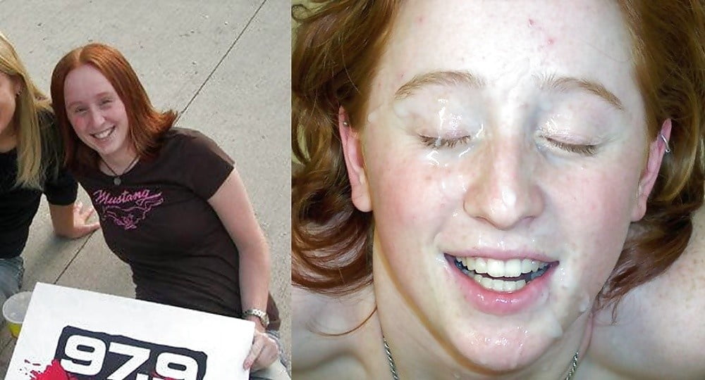 Before and After Facial Friday edition - 25 Photos 