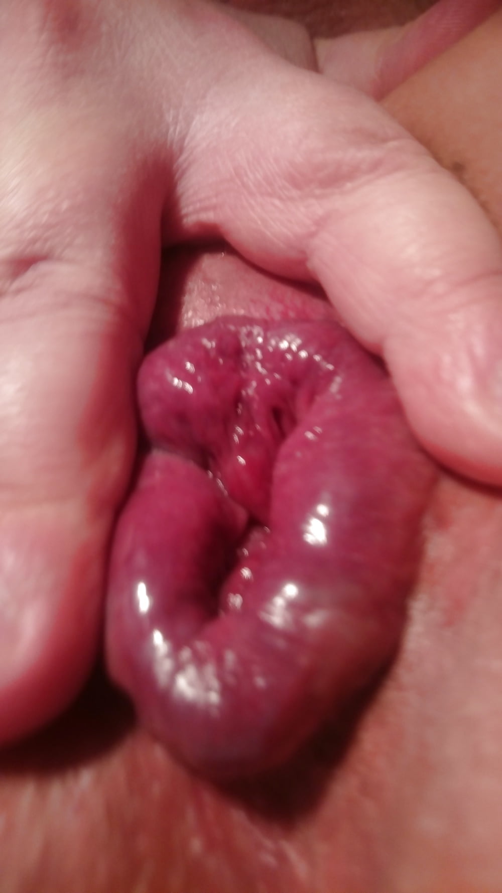 Sex Bumhole (light prolapse) image