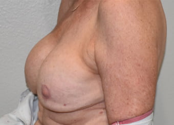Saggy breast 65-74 - 40 Pics 