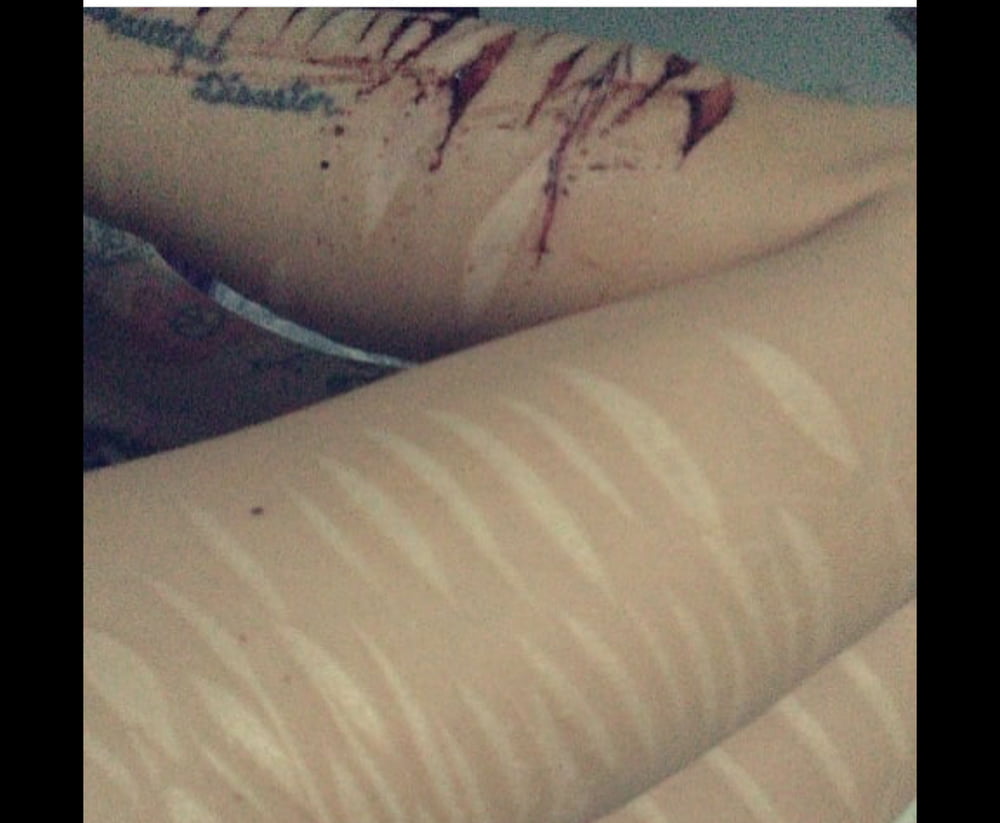 Sex Suicidal Slut image