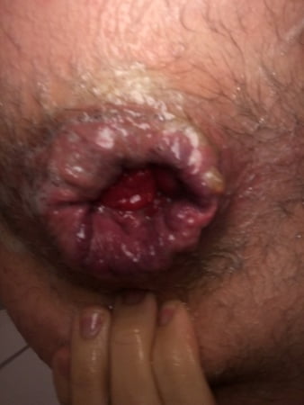 even more